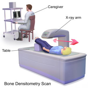Bone desitrometry scan