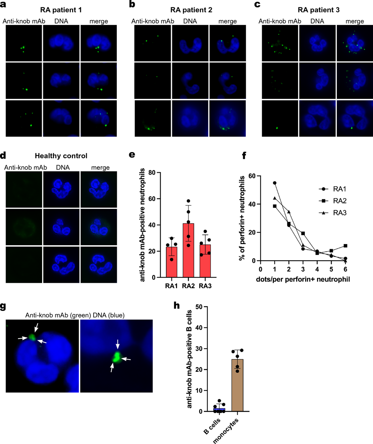 Fig 2 Evidence of membranolytic 
