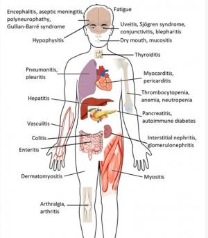 Diagram of immune related events on the body