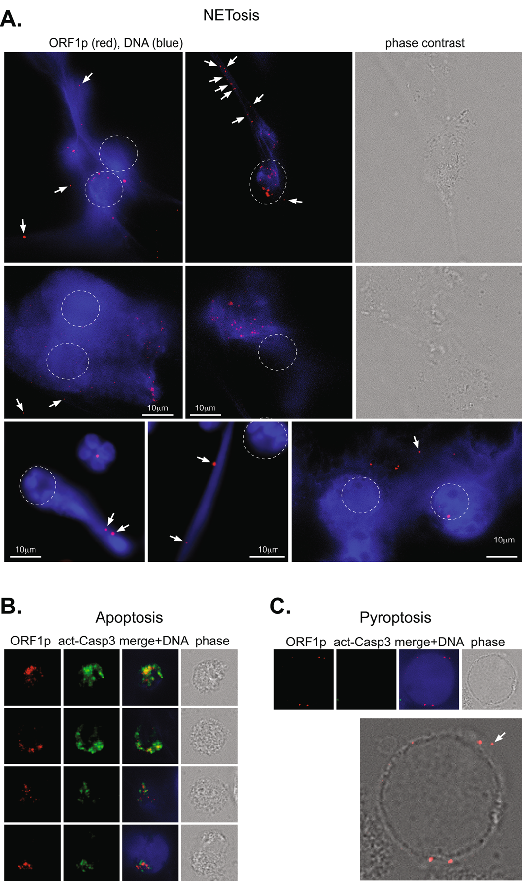 Subcellular location of L1 