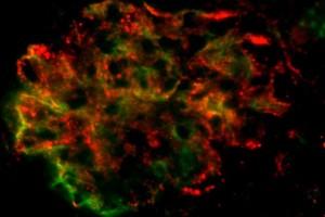 Kidney glomerulus